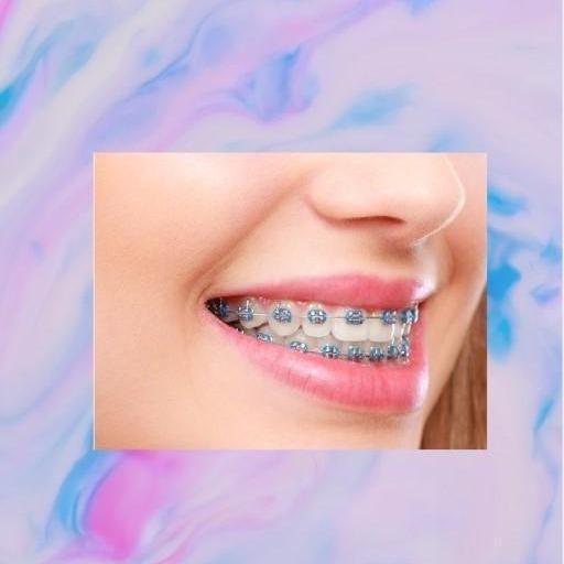 Ortho Legation Tool Decoration for Cosplay Smile, Braces - Cosplay Smile