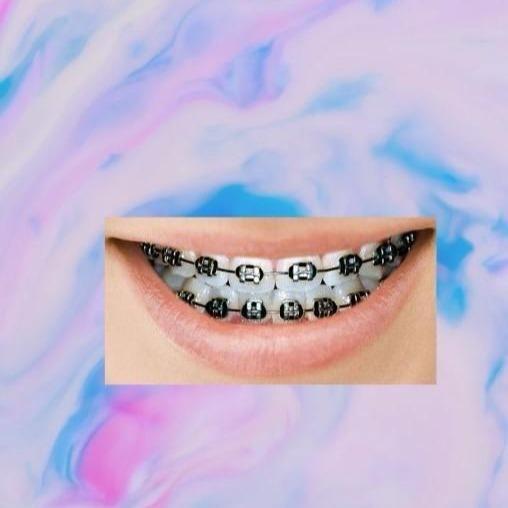 Ortho Legation Tool Decoration for Cosplay Smile, Braces - Cosplay Smile